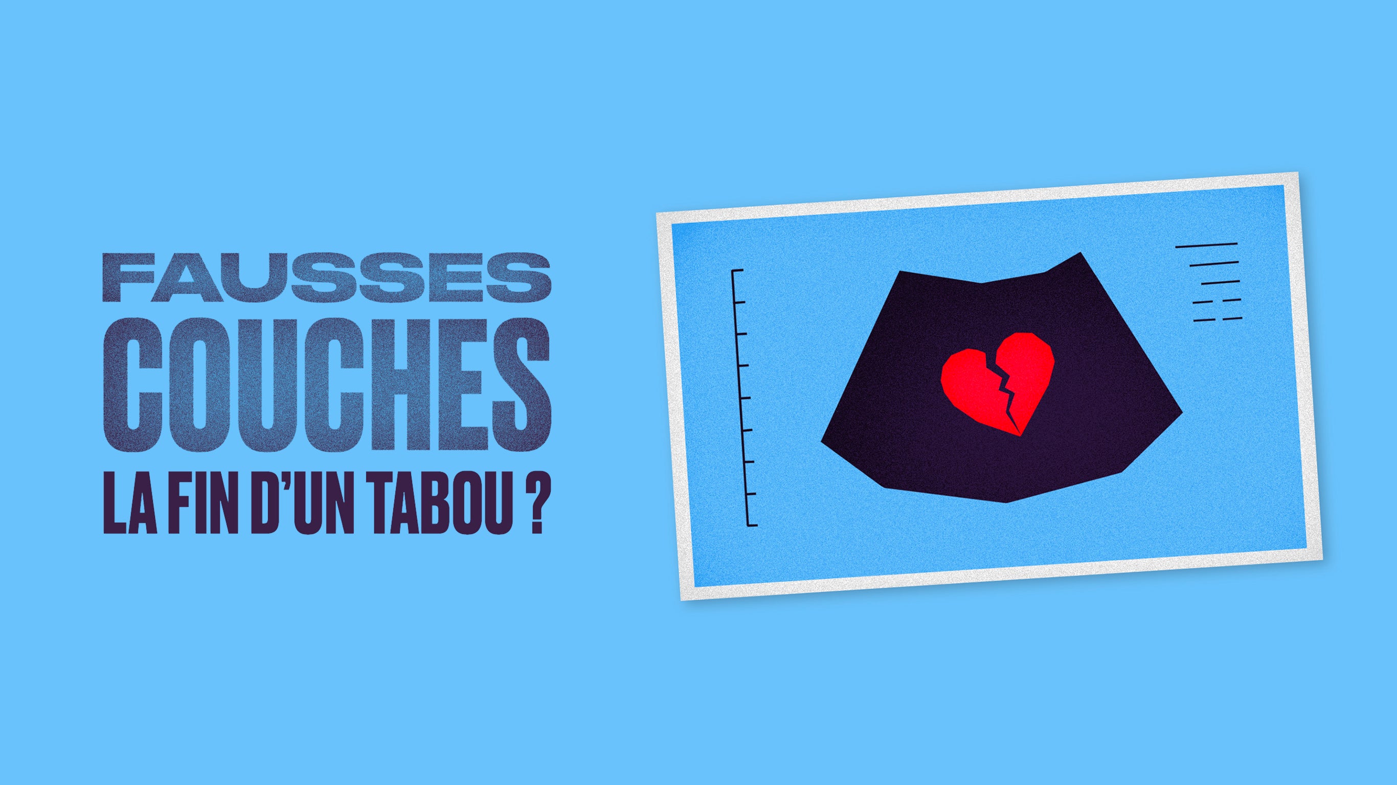 Fausses couches : la fin d'un tabou ?