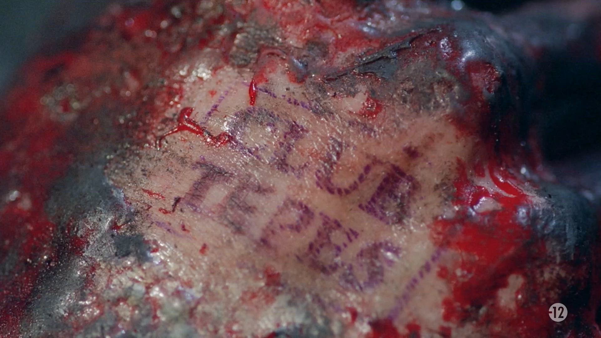 S2 E7 - Les vampires